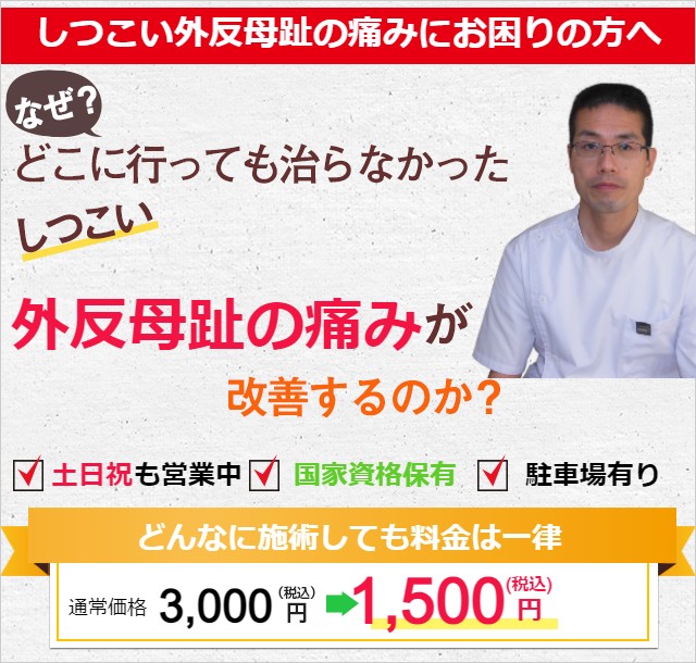 外反母趾の痛みのヘッダー画像