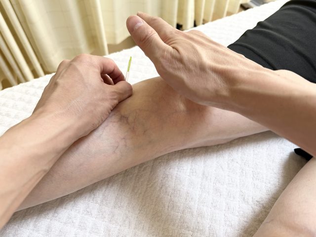 下腿に施術を行っている写真の施術写真